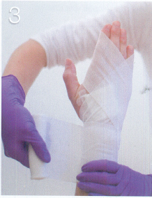 Hand Bandage